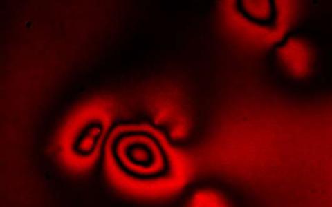 肥皂泡的光学如何帮助我们了解免疫细胞和癌症的机制