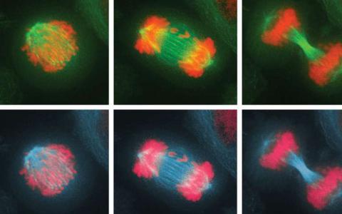 生物学家发现免疫系统可以消除染色体过多或过少的细胞