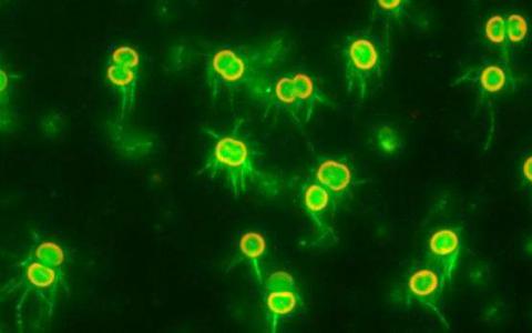 研究人员阐明了原核生物中超分子运动的动力学