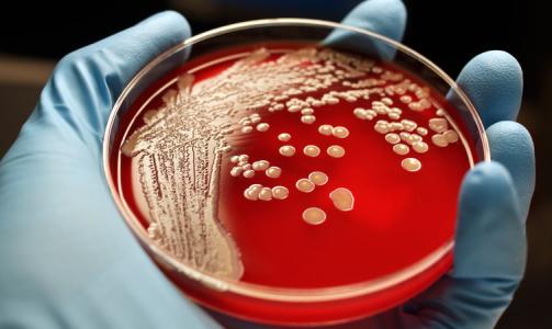 认为无敌的超级细菌可以屈服于抗生素组合