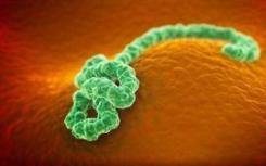 孤立的埃博拉病例难以诊断未被发现