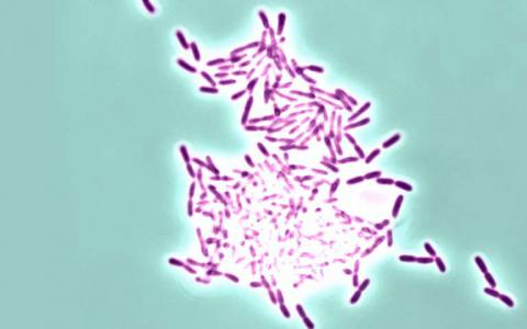 生物膜发现提出了预防危险感染的新方法