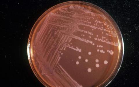 细胞如何对抗沙门氏菌