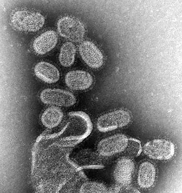 研究人员发现流感病毒如何劫持人体细胞