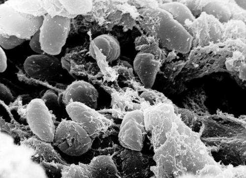 瘟疫细菌在变形虫中避难
