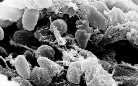 瘟疫细菌在变形虫中避难