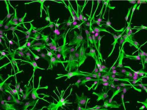 周细胞在预防神经变性中发挥关键作用