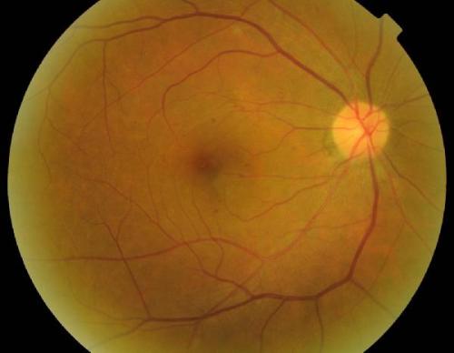 研究揭示了视网膜中视紫红质的动态变化