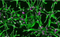 周细胞在预防神经变性中发挥关键作用