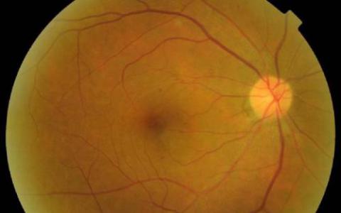 研究揭示了视网膜中视紫红质的动态变化