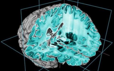 研究揭示了大脑的基本结构是如何形成的