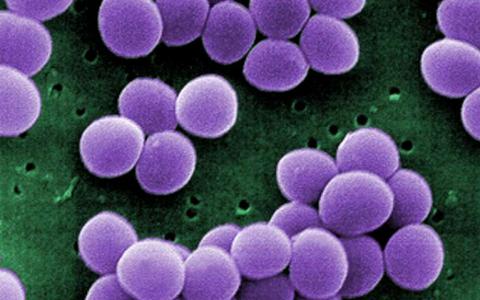 原子级运动可能会驱动细菌逃避免疫系统防御的能力