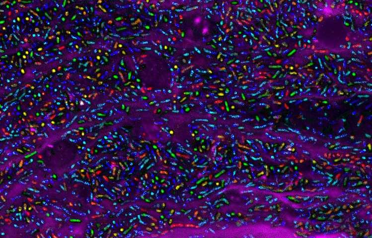 新工具可视化细菌物种在肠道中的位置控制它们的活动