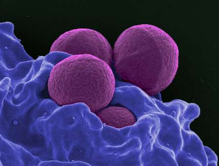 科学家设计人类胚芽杂交分子来攻击耐药细菌