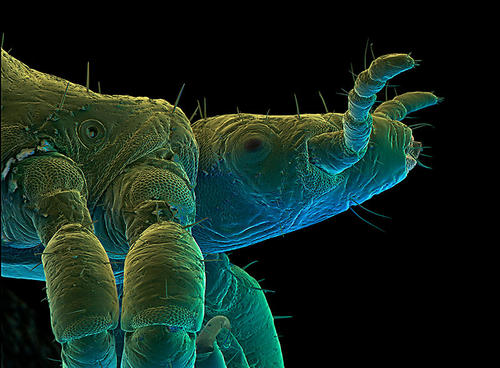 虱子和它们的细菌伙伴一起进化了数百万年