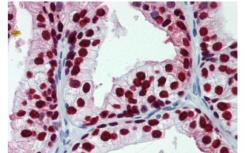 FOXA1突变改变了开创性活动分化和前列腺癌表型