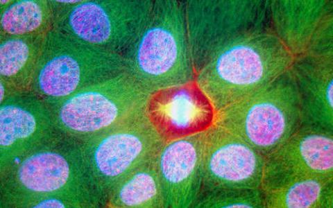 蛋白质复合物调节上皮细胞如何结合在一起可能导致新的癌症见解