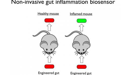 合成生物学家设计炎症感应肠道细菌