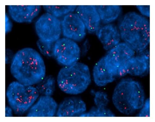 分子印迹纳米粒对HER2对肿瘤细胞的抑制作用