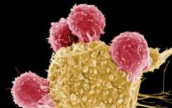 聚合物包覆的金纳米球不会损害人B淋巴细胞的先天免疫功能