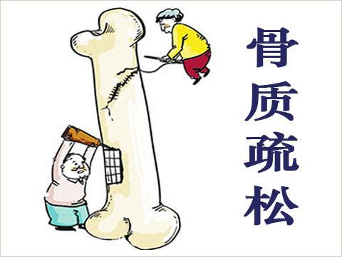  骨科医生经常用沉默病来比喻骨质疏松