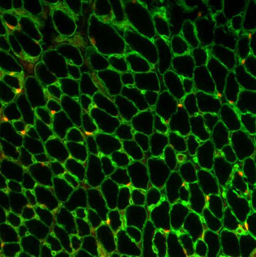 归巢本能应用于干细胞显示细胞家到心脏组织