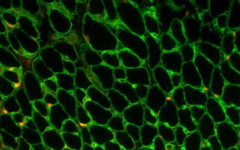 归巢本能应用于干细胞显示细胞家到心脏组织