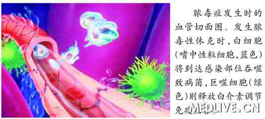 医生声称使用维生素C 类固醇治疗脓毒症