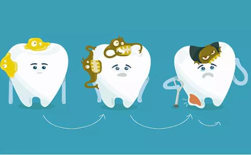 蛀牙是指附着在牙齿上的蛀牙菌在釉质和象牙质上留下破洞的状态