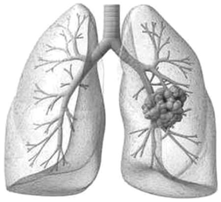 高剂量利福平在肺结核中的疗效和安全性