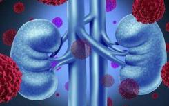 研究将测试危及生命的肾脏疾病IgA肾病的新疗法
