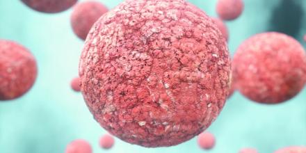 霍奇金淋巴瘤是一种B细胞恶性淋巴瘤