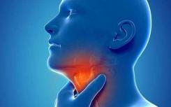 喉癌早期症状主要表现为咽部异物感 吞咽不适等 容易误诊为咽炎