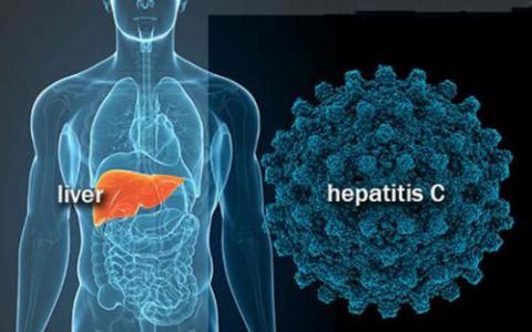 新的经济实惠的丙型肝炎联合治疗显示97％的治愈率