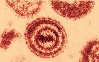 水痘是由水痘带状疱疹病毒引起的急性呼吸道传染病