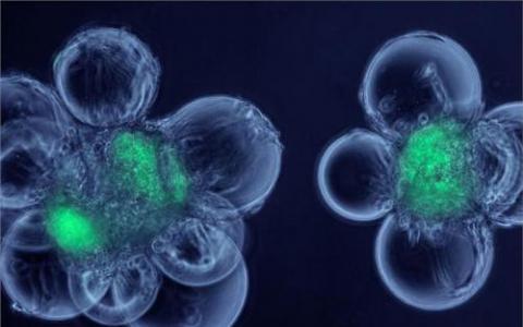 近年来胚胎干细胞治疗该类疾病研究逐渐深入