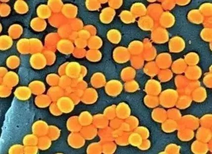 研究人员发现了攻击金黄色葡萄球菌的新方法