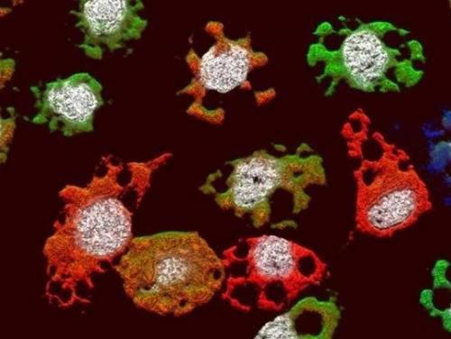 极端病毒病毒SIRV2可以帮助杀死炭疽病毒 其他病原体