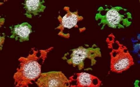 极端病毒病毒SIRV2可以帮助杀死炭疽病毒 其他病原体