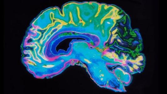 大脑扫描预测你的学习技巧