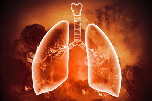研究显示了严重肺病的惊人趋势