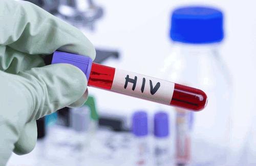 基于GP的HIV检测具有成本效益 应在地方当局推出