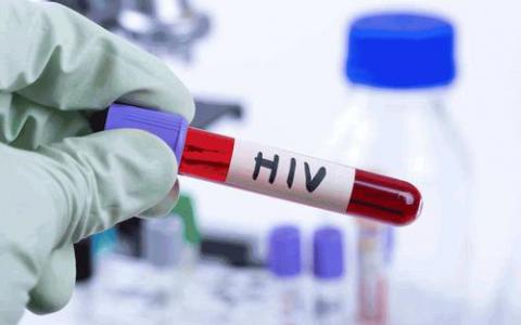 基于GP的HIV检测具有成本效益 应在地方当局推出