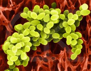 技术可以更好地治疗金黄色葡萄球菌败血症 由 美国微生物学会
