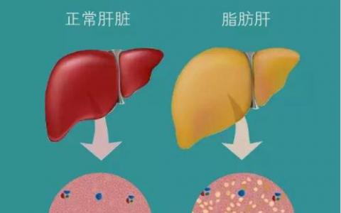 在美国丢弃的许多肾脏将被移植到法国