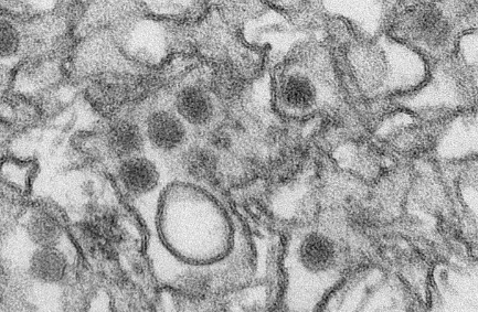 研究表明 先前的病毒感染可使寨卡病毒感染恶化