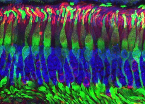 视网膜芯片将活体人体细胞与人造组织样系统结合在一起