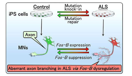 研究人员找到了一种新的ALS病理介质