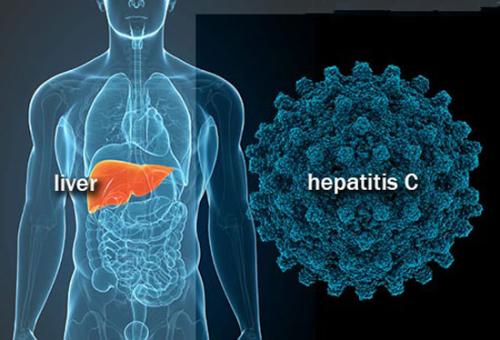 实验室研究显示 丙型肝炎突变超过免疫系统