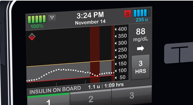 Tandem使第一台可互操作的胰岛素泵获得FDA的好评